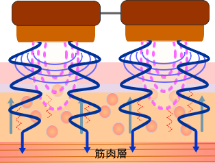 世界初のツインヘッド